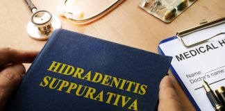 Idrosadenite suppurativa: rimedi naturali e consigli della nonna Idrosadenite suppurativa